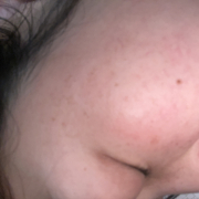 「しみとたるみが気になる」シミキールナイトバームの&rdquo;発売前先行モニター&rdquo;募集♡の投稿画像