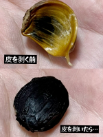 熟成黒にんにく「黒青森」にんにくの中でも最高級品種といわれる「青森県産 福地ホワイト」を使用した熟成黒にんにくです。💡こんな方におすすめ・慢性的な疲れを感じている・肩こりや疲れがたまっ&hellip;のInstagram画像