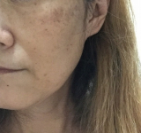 シミがなかなか消えないので試したいです。