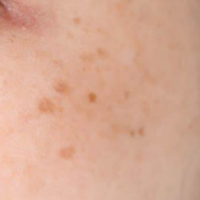 「シミ」【先行モニター】&rdquo;発売前先行モニター&rdquo;募集♡の投稿画像