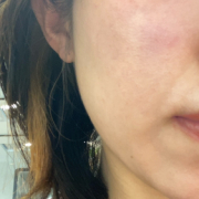 「毛穴、シミ、テカリに…」【先行モニター】&rdquo;発売前先行モニター&rdquo;募集♡の投稿画像