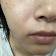 「くすみ、毛穴、シミが気になります」【先行モニター】&rdquo;発売前先行モニター&rdquo;募集♡の投稿画像