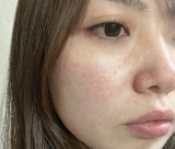 「肌悩み」の画像（1枚目）