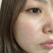 「肌悩み」【先行モニター】&rdquo;発売前先行モニター&rdquo;募集♡の投稿画像