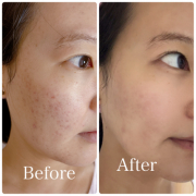 「肌の悩み」【先行モニター】&rdquo;発売前先行モニター&rdquo;募集♡の投稿画像