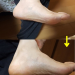 マックスの無添加ボディミルクモニターした。乾燥肌の高齢夫婦で使用してみたら、しっとり、つやつやに！赤ちゃんにも安全というだけあってもはや手放せない。じいじは背中に塗ったが保湿性ばっちり。かさかさで痒か&hellip;のInstagram画像