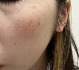 シミくすみが気になります