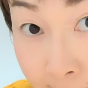 「くまやそばかすに悩まされています。」【限定20名！現品モニター】新商品を現品でお届け♪ 使ってみた感想をInstagramに投稿してくれる方募集♡の投稿画像