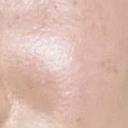 「シミそばかす」【限定20名！現品モニター】新商品を現品でお届け♪ 使ってみた感想をInstagramに投稿してくれる方募集♡の投稿画像