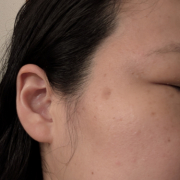 「保湿やマスクを利用し、薄くはなっているものの、大きなシミに悩んでいます」【限定20名！現品モニター】新商品を現品でお届け♪ 使ってみた感想をInstagramに投稿してくれる方募集♡の投稿画像