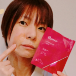 ○※4,200本のヒアルロン酸針で口元集中ケア※::::::::::::::::::::::::::::::::::::::::::::::::::::::::::::::::::::::::::&hellip;のInstagram画像