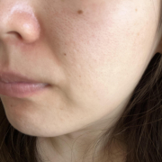 「毛穴部分」【限定20名！現品モニター】 美容液成分94％配合のピーリングバームの感想をInstagramに投稿してくれる方募集♡の投稿画像