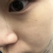 「細かいごわつき、そばかす」【限定20名！現品モニター】 美容液成分94％配合のピーリングバームの感想をInstagramに投稿してくれる方募集♡の投稿画像