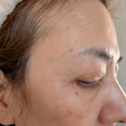 「肌悩み」【限定20名！現品モニター】 美容液成分94％配合のピーリングバームの感想をInstagramに投稿してくれる方募集♡の投稿画像