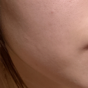 「花粉の洗礼」【限定20名！現品モニター】 美容液成分94％配合のピーリングバームの感想をInstagramに投稿してくれる方募集♡の投稿画像