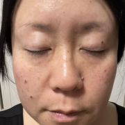 「シミ、そばかすが悩みです」【限定20名！現品モニター】 美容液成分94％配合のピーリングバームの感想をInstagramに投稿してくれる方募集♡の投稿画像