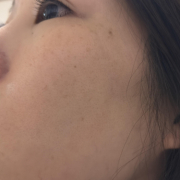 シミ、毛穴が気になります。