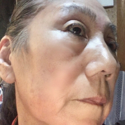 鼻の毛穴も気になります