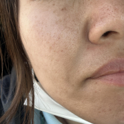 毛穴がすごい