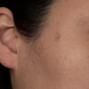 「シミや乾燥に悩んでいます。剥がさないピーリングに惹かれました」【限定20名！現品モニター】 美容液成分94％配合のピーリングバームの感想をInstagramに投稿してくれる方募集♡の投稿画像