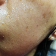 「肌悩みいっぱい(ToT)」【限定20名！現品モニター】 美容液成分94％配合のピーリングバームの感想をInstagramに投稿してくれる方募集♡の投稿画像