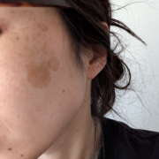 「肌悩み」【限定20名！現品モニター】 美容液成分94％配合のピーリングバームの感想をInstagramに投稿してくれる方募集♡の投稿画像