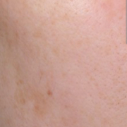 「くすみ・シミ」【限定20名！現品モニター】 美容液成分94％配合のピーリングバームの感想をInstagramに投稿してくれる方募集♡の投稿画像