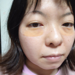 sirayukiringoです🍎🍏コスメディ製薬株式会社様から商品提供いただぎました。「クオニス　ダーマフィラープレミア」（目もと用マイクロニードルパッチ）就寝前に化粧水と乳液を使ったあと&hellip;のInstagram画像