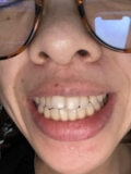 歯