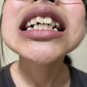 「娘」【現品長期モニター募集！】シリーズ販売累計750,000本突破した美白歯みがきジェルのリニューアル品をモニターいただける方募集！の投稿画像