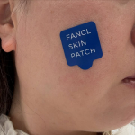 2回目行ってきた！FANCL SKIN PATCHを体験してきました♪先日体験したスキンパッチの2回目を測定に行ってきました。1回目の時、コラーゲンの生成にポイントを置きケアするとより良いと&hellip;のInstagram画像