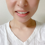 ツルツルで白い歯に。。