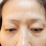 まぶたの下がりやクマ