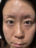 若い頃は自慢の二重でした
