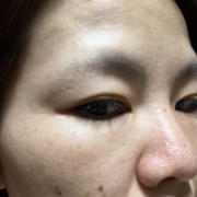 「重たい二重まぶた、、」先行モニター♪【たるみ・重たいまぶた・不安定な二重ラインが気になる方へ】目元ケア商品モニター大募集！の投稿画像
