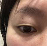 瞼おもい
