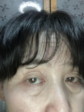目が重い