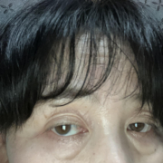 「目が重い」先行モニター♪【たるみ・重たいまぶた・不安定な二重ラインが気になる方へ】目元ケア商品モニター大募集！の投稿画像