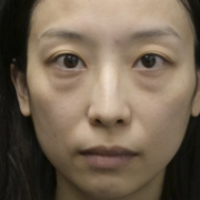 「目のたるみ」先行モニター♪【たるみ・重たいまぶた・不安定な二重ラインが気になる方へ】目元ケア商品モニター大募集！の投稿画像
