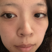 「左が広い二重幅です」先行モニター♪【たるみ・重たいまぶた・不安定な二重ラインが気になる方へ】目元ケア商品モニター大募集！の投稿画像