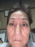 73歳です