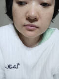 最近ほうれい線が気になっております