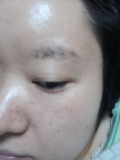 目元の乾燥が気になっております