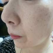 「たるみ・・・ほうれい線、眉間のしわ。本当にいやになります！」【現品長期モニター募集！】口元のハリ不足、気になっていませんか？「タイトリフトセラム」2ヶ月長期モニターいただける方募集！の投稿画像