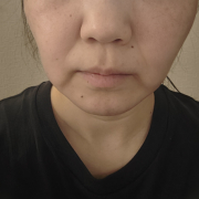 「ほうれい線と口元のたるみ」【現品長期モニター募集！】口元のハリ不足、気になっていませんか？「タイトリフトセラム」2ヶ月長期モニターいただける方募集！の投稿画像