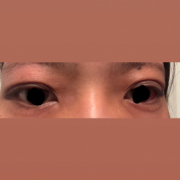 「乾燥、たるみ」【現品長期モニター募集！】2ヶ月じっくり、目元ケア体験！目元用パック「アイタイトセラム」長期モニターいただける方募集！の投稿画像