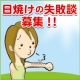 イベント「【コメント募集♪】あなたの日焼けの失敗談を聞かせて下さい！」の画像