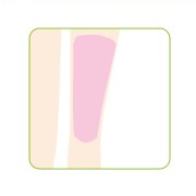 ヒザ上脱毛の口コミ（クチコミ）情報の商品写真