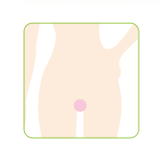 Oライン脱毛の口コミ（クチコミ）情報の商品写真