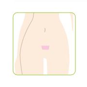 Ｖライン脱毛（トップ）の口コミ（クチコミ）情報の商品写真